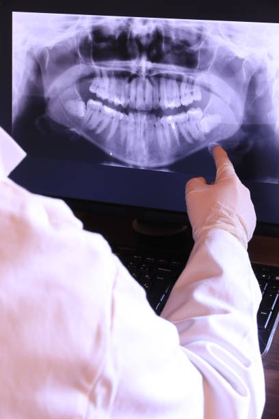 Best Emergency Tooth Extraction in Palmdale, CA